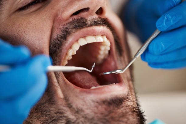 Laser Dentistry in Folsom, CA